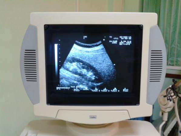 ALOKA Алока 1400 аппарат сканер УЗИ ультразвуковой диагностики в Краснодаре фото 12