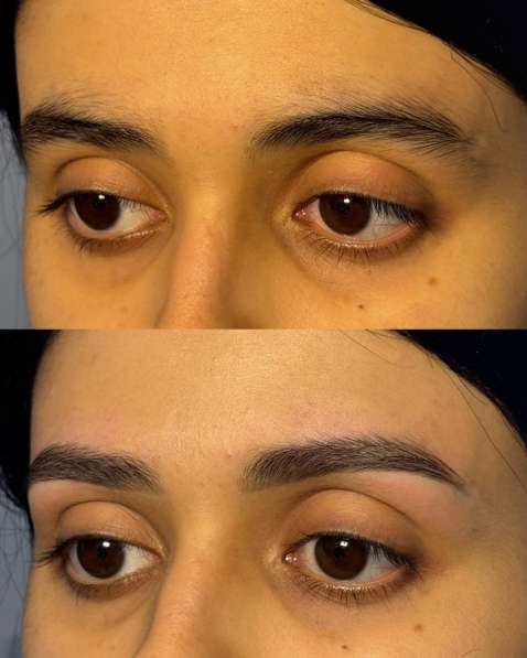 Бровист в Норильске фото 3