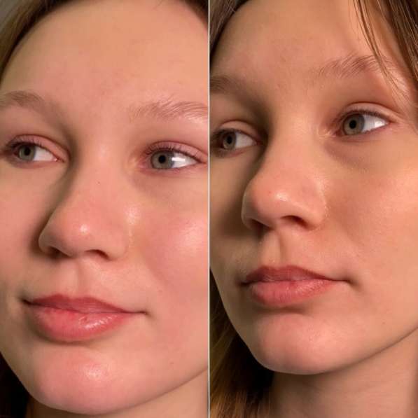 Комплекс бровей в Москве фото 5